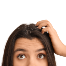 Productos para cabello graso y con caspa